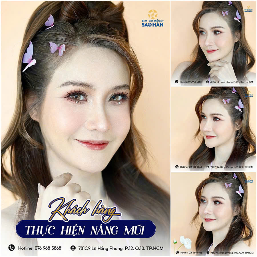 Bệnh viện thẩm mỹ Sao Hàn