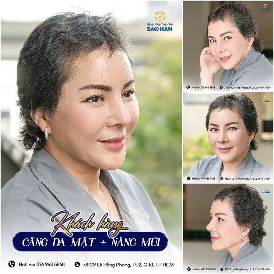 Bệnh viện thẩm mỹ Sao Hàn