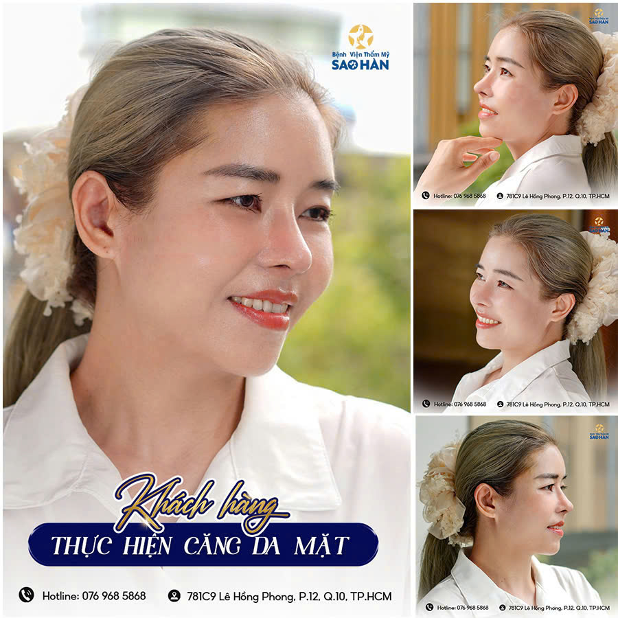 Bệnh viện thẩm mỹ Sao Hàn