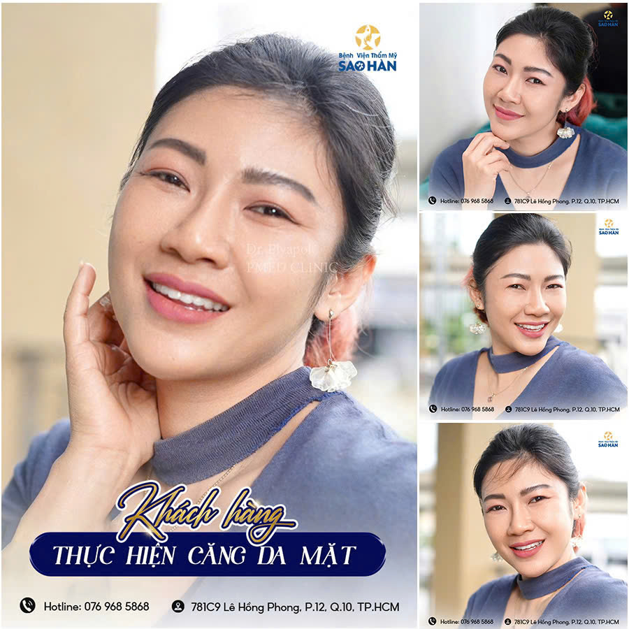 Bệnh viện thẩm mỹ Sao Hàn